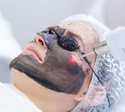 Benefits of Carbon Laser Treatment in Baner