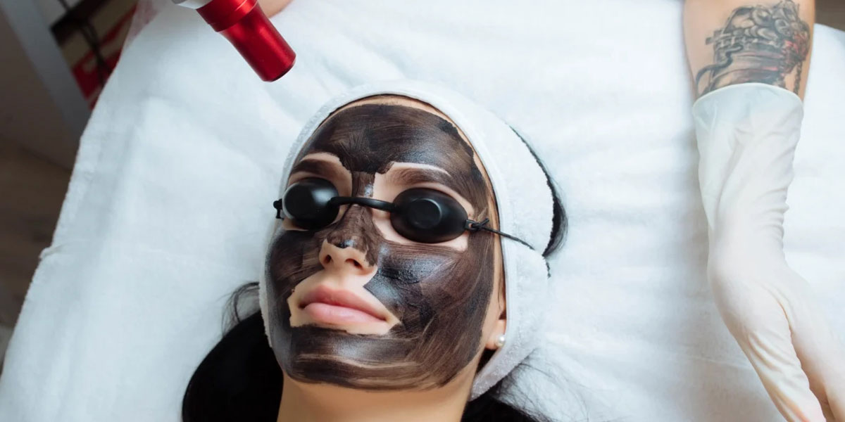 Carbon Laser Treatment in Baner