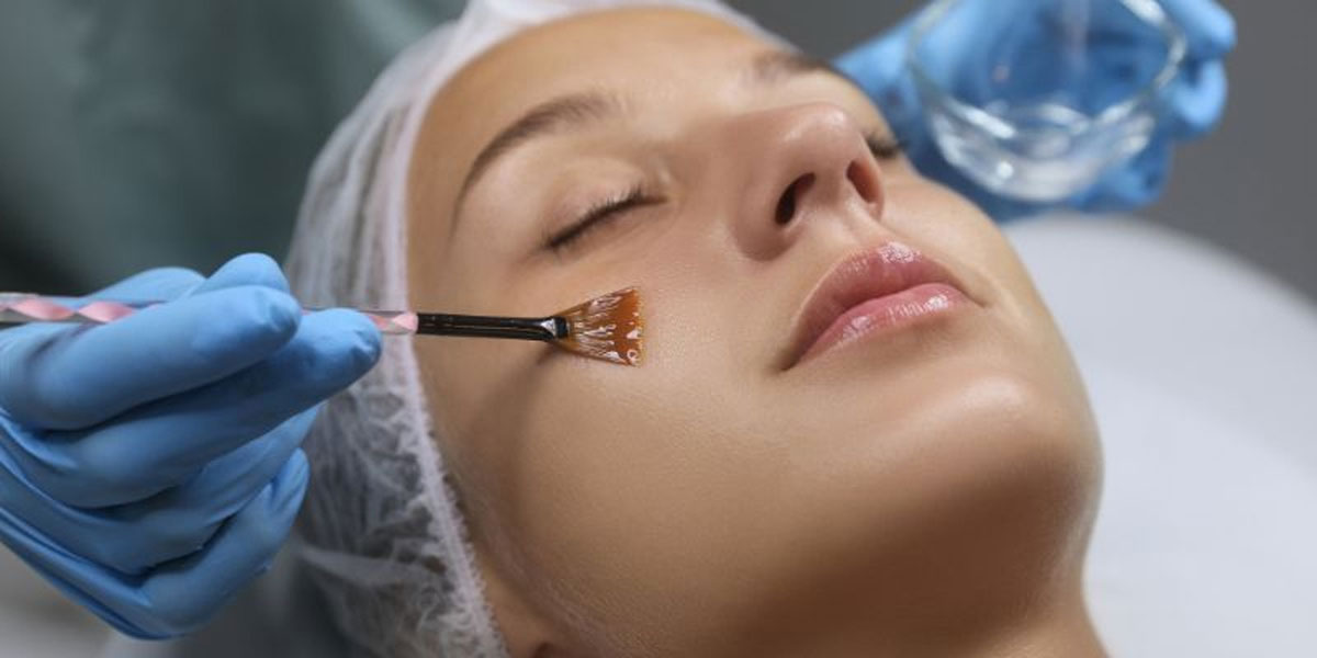 Chemical Peel Treatment in Baner