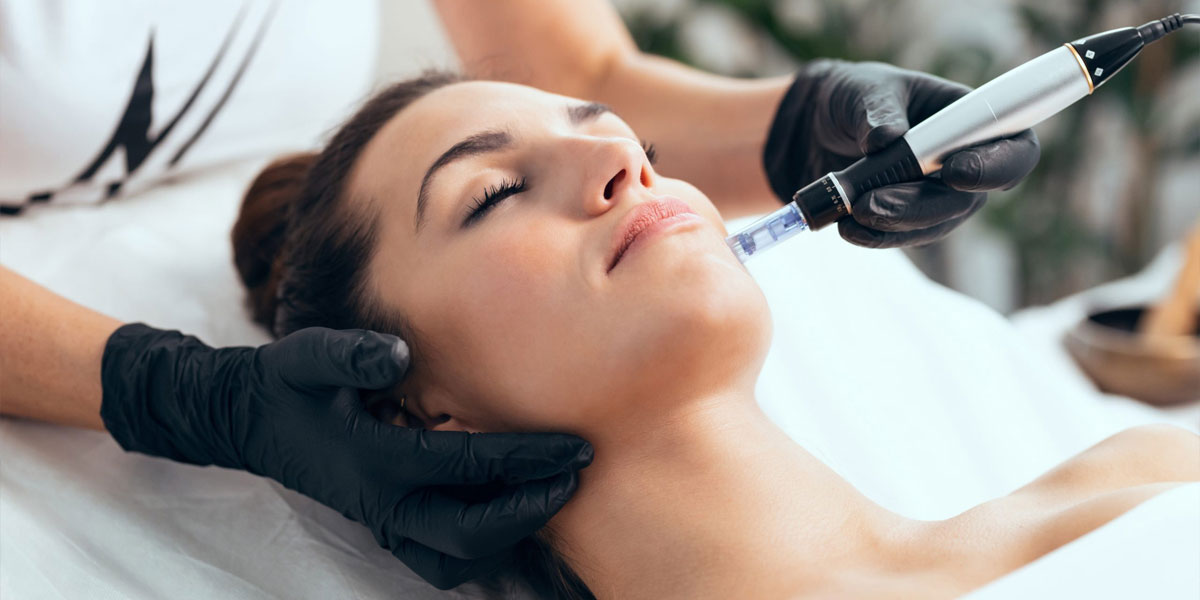 Microneedling Treatment in Baner