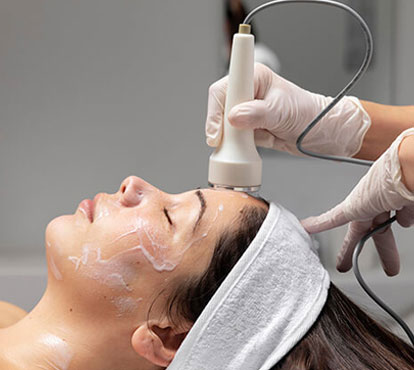 Photo Facial Treatment Benefits