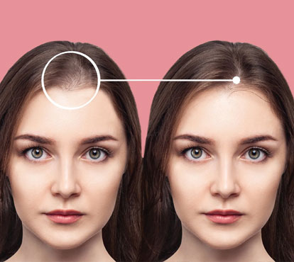 QR678 Hair Treatment