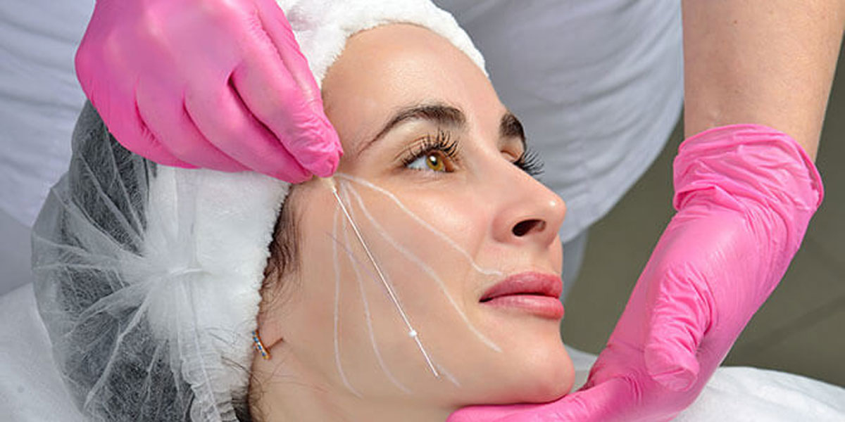 Threads Lift Treatment in Baner