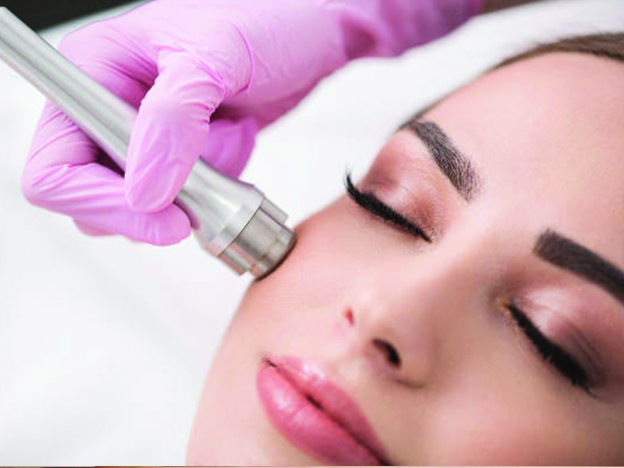 Microdermabrasion for Face & Full Body